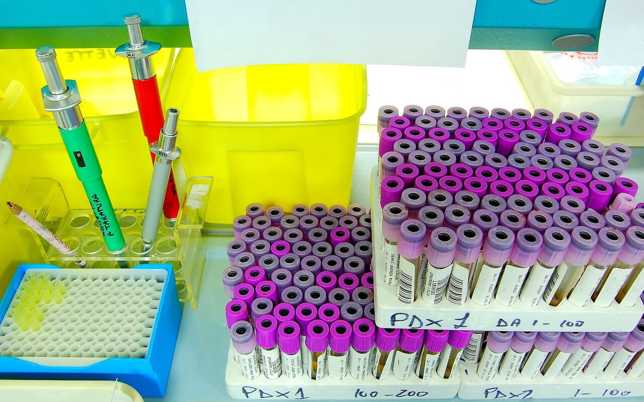 Laboratory scene illustrating peptide research from Obesity (Silver Spring, Md.)